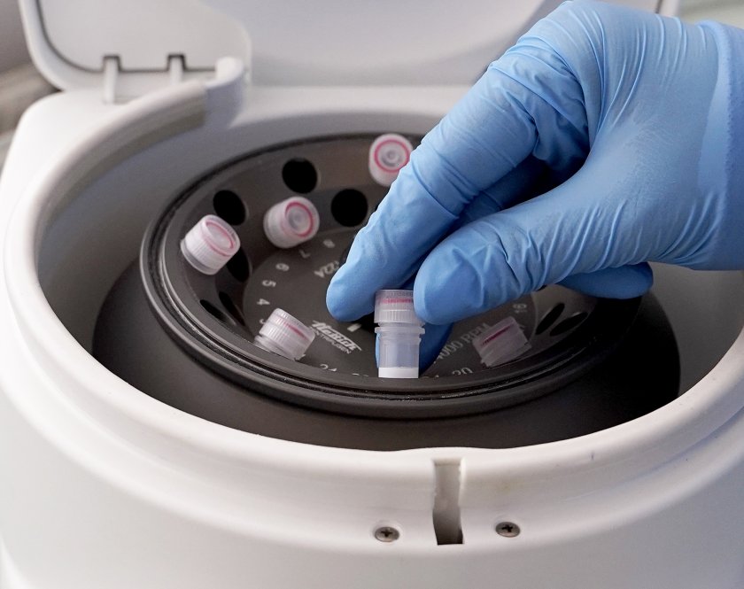 Ръст на заразените с COVID-19 у нас, общият брой вече е 915