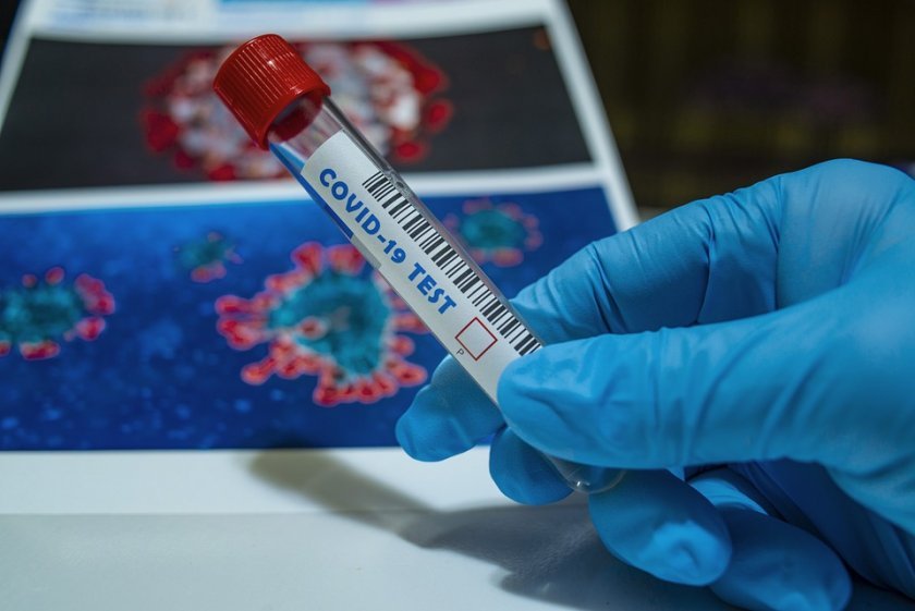 10 нови случая на коронавирус у нас за днес, трима са починали