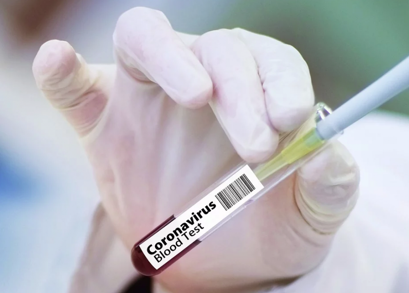заразените коронавирус света увеличиха 000 денонощие