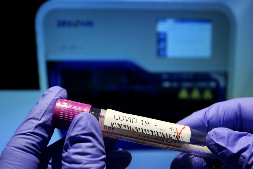 75 доказани нови случаи на коронавирус в България