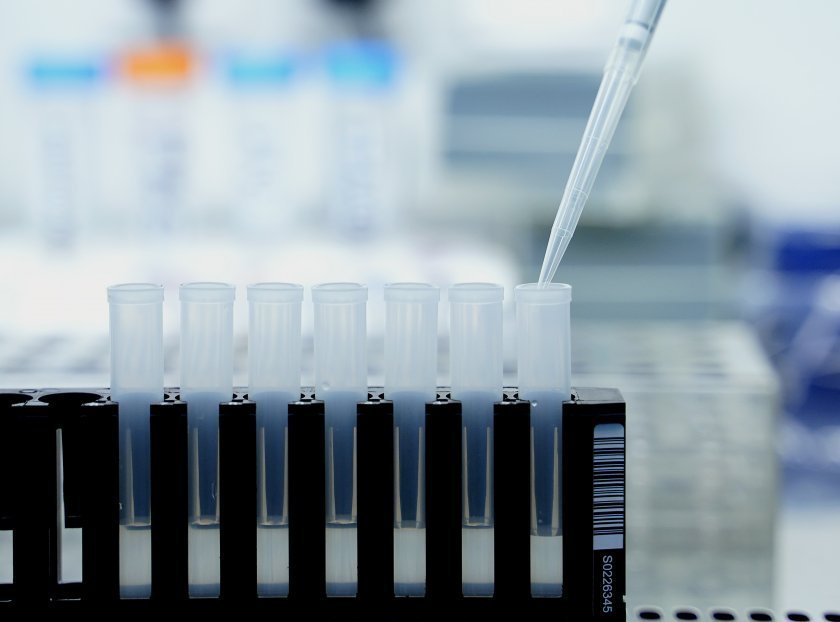 54 заразени с коронавирус в селище "Качулка"