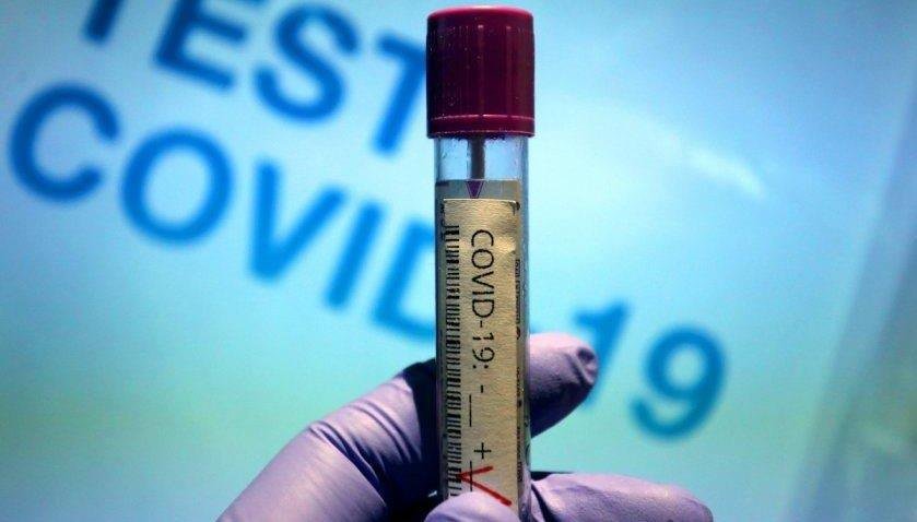 81 нови случая на COVID-19 за последното денонощие
