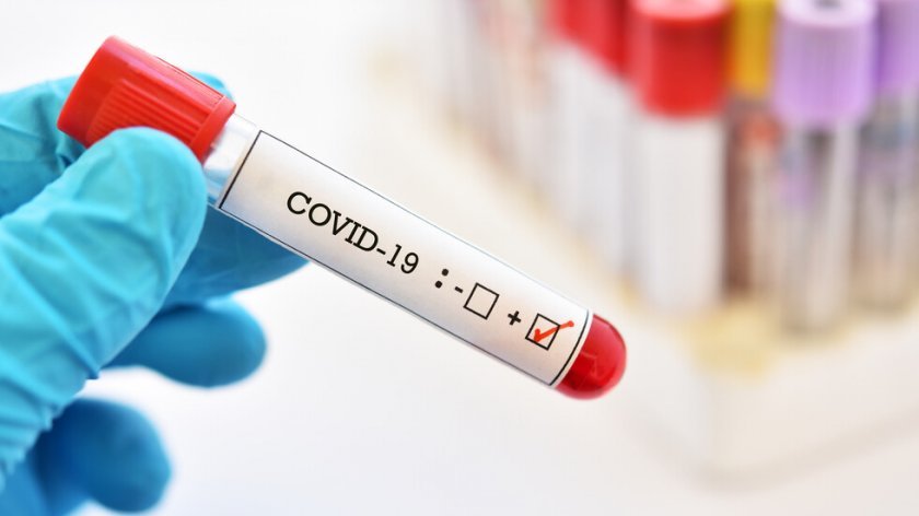 293-ма души са новозаразените с коронавирус през последното денонощие, показват