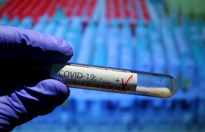 Нарастват случаите на COVID-19 у нас - 429 са заразените за денонощието