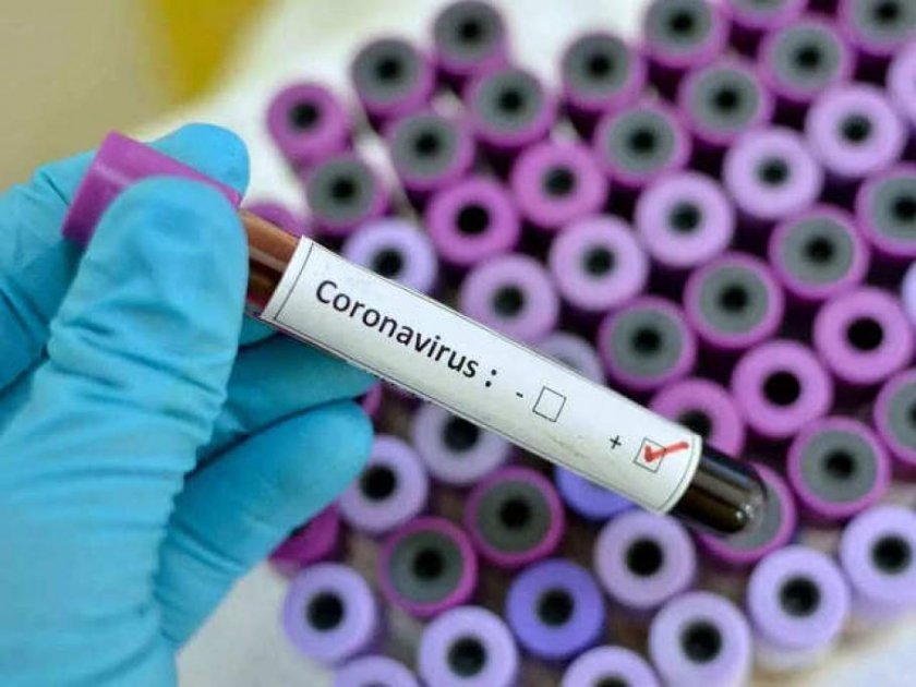 488 нови случаи с коронавирус у нас.4% от направените 12