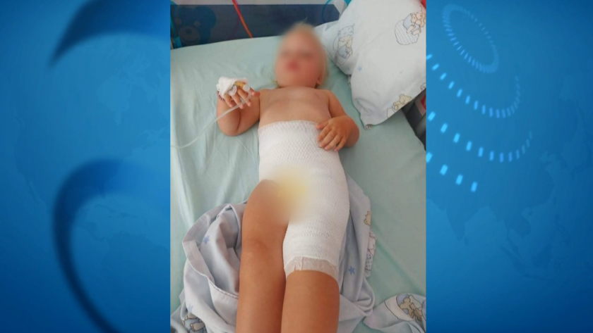 Дете е със сериозни изгаряния след посещение на столична ясла.