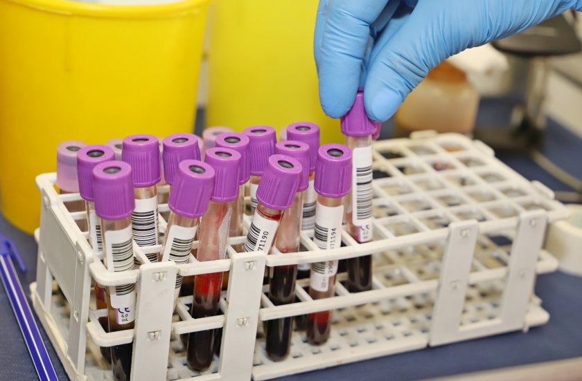 Над 93 000 са вече активните случаи на коронавирус в