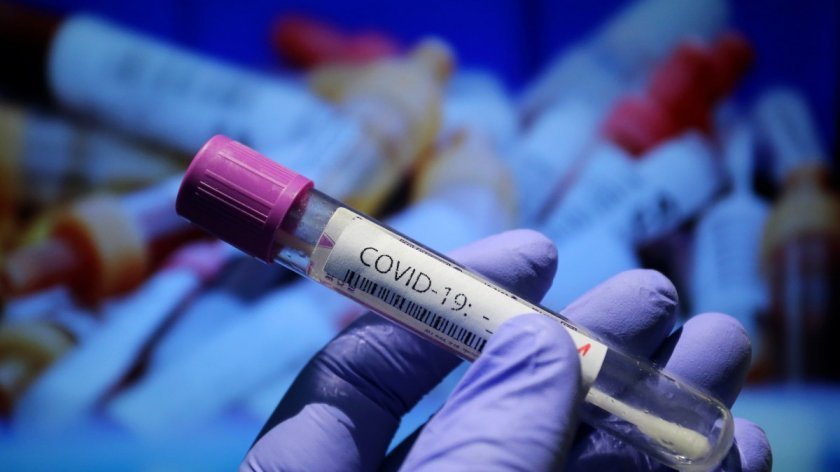 3233 нови случаи на COVID-19 за денонощието, 9,6% са положителните проби