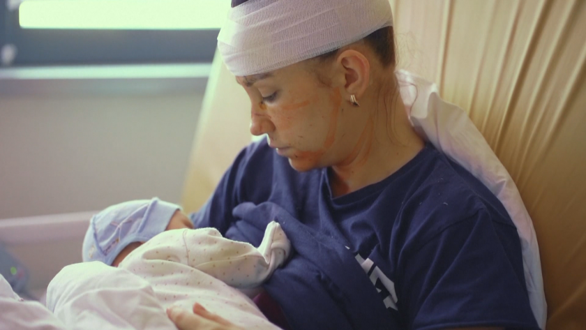 27-годишната Олга е тежко ранена след ракетен удар в Киев,