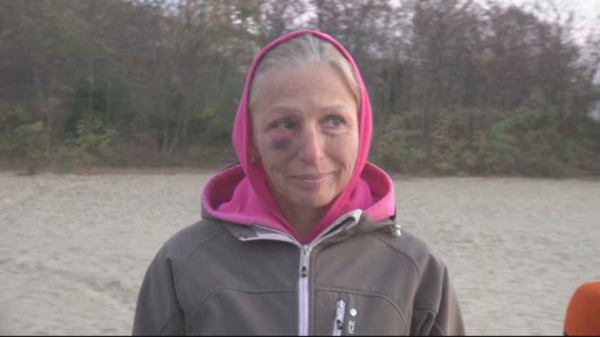 Жена беше нападната от три кучета на плажа в Несебър,