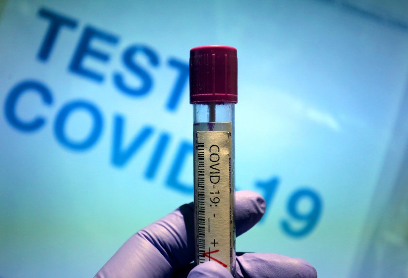 410 новите случаи коронавирус последното денонощие