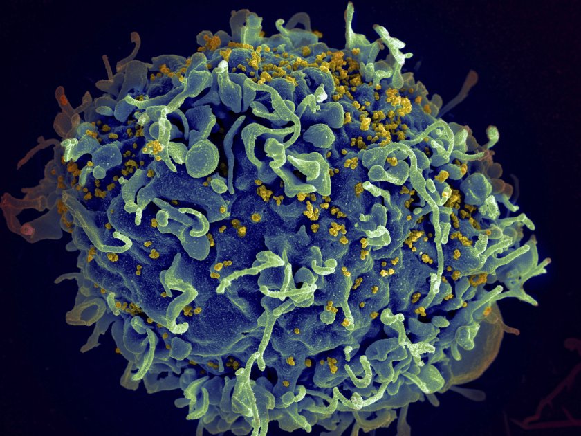 Учени елиминираха ХИВ от клетки чрез технология за редактиране на гени в лабораторни условия