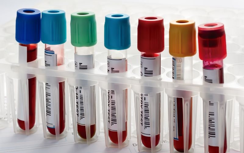 Researchers at Varna Medical University Develop New Biomarkers for Cardiovascular and Oncological Diseases