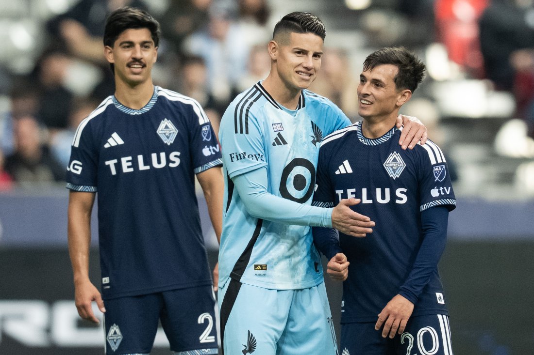 Хамес Родригес прекара 72 часа в болница след контролата с Франция