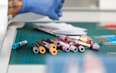 Здравното министерство не одобрява идеята за задължителен PCR тест при влизане в болница