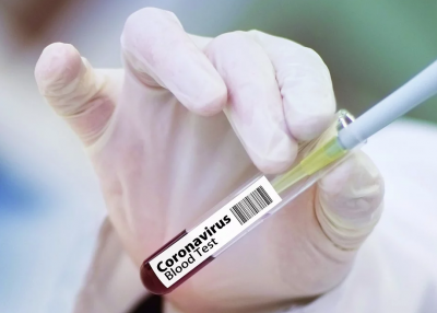 22 000 наближава броят на заразените с COVID-19 в Румъния