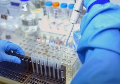 119 нови случаи на коронавирус у нас при направени 1491 PCR теста