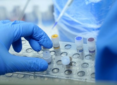 27 случая на коронавирус при 924 PCR теста
