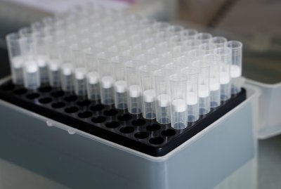 86 случая на коронавирус при 2915 PCR теста