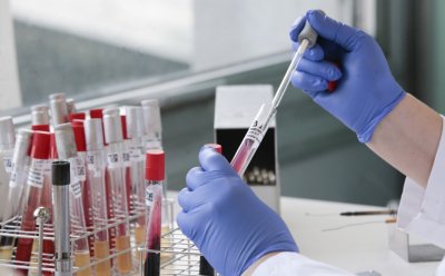 Ако сме имали контакт с болен: Кога трябва да си направим PCR тест?