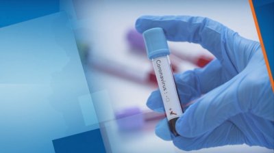 4382 случая на коронавирус при 10 474 теста