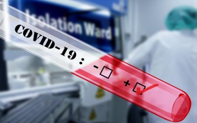 Личните лекари вече дават направление за безплатен PCR тест за COVID-19