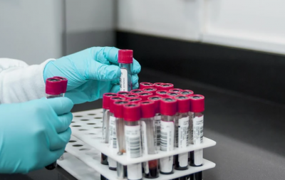 739 нови случая на коронавирус при направени 1965 PCR теста