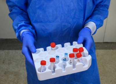 Опашки за PCR - как се справят лабораториите с нарастването на тестваните