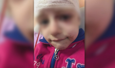 Питбул, оставен без контрол, нахапа 4-годишно момиченце в София