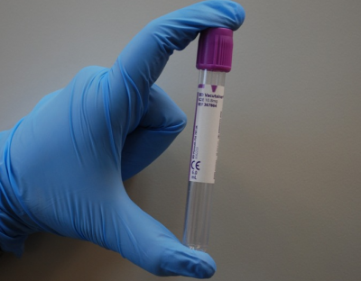 549 са новите случаи на коронавирус през изминалото денонощие Отчита
