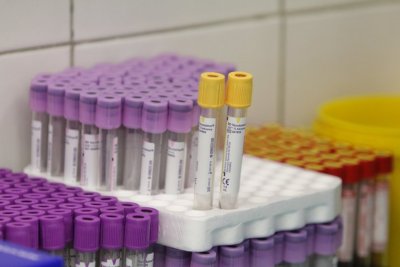 1601 нови случаи с коронавирус Това са 7 положителни проби