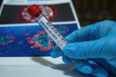 2181 нови случаи с коронавирус са отчетени за последното денонощие Направени