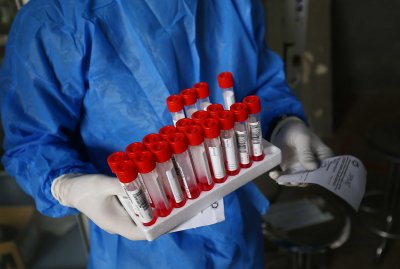 1943 са новите случаи на коронавирус у нас за последните