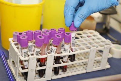 126 са новите случаи на коронавирус при направени 2694 теста