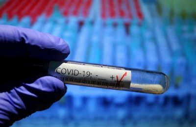 182 са новите случаи на коронавирус у нас за последното
