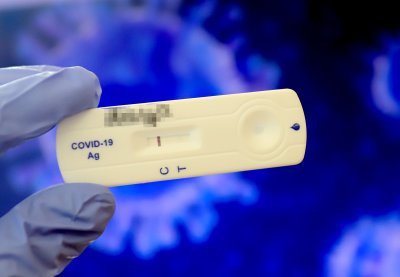513 са новите случаи на коронавирус у нас за последното