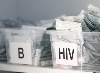 СЗО предупреждава за увеличаване на случаите на ХИВ в Европа