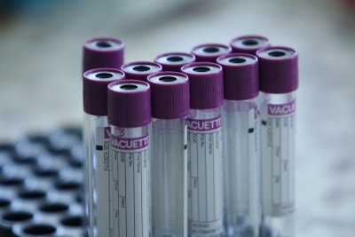 69 нови случая на коронавирус са били регистрирани през последното