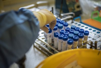 26 нови случая на коронавирус, четирима са починали