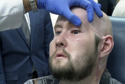 Американски лекари извършиха първата в света трансплантация на цяло око