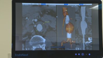 Military Medical Academy hosts a forum on the treatment of aortic diseases