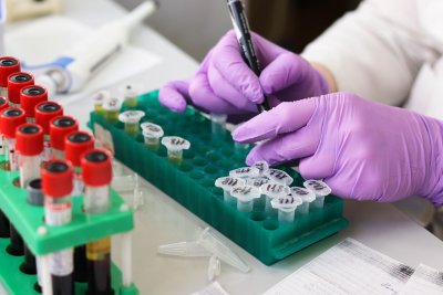 Ще бъдат открити 4 нови лаборатории за кръвни проби