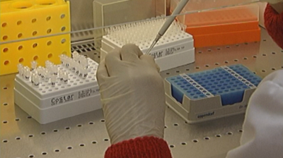 Ръст на случаите с морбили: Инфекциозното отделение в Бяла Слатина е пълно