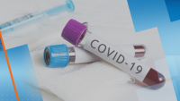 379 са заразените с COVID-19 у нас