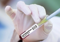 35 са общо смъртните случаи от коронавирус у нас, расте броят на заразените медици