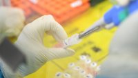 Липсват PCR тестове в Плевенско
