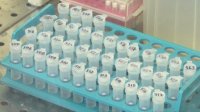 Болници карат постъпващи пациенти да си плащат за PCR тест