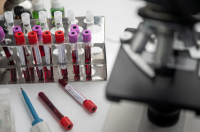 Възобновиха тестовете на ваксината срещу коронавивус