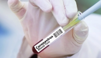 154 са новите случаи на коронавирус в страната