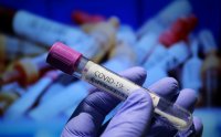 1799 са новите случаи на коронавирус при 6233 PCR теста